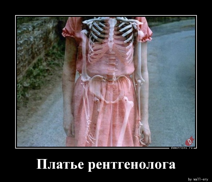 Платье рентгенолога