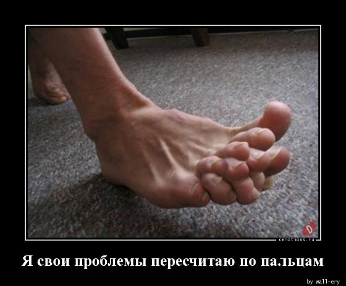 Перепонки между пальцами у мужчин. Пальцы ног перекрещены. Скрещивание пальцев на ногах.
