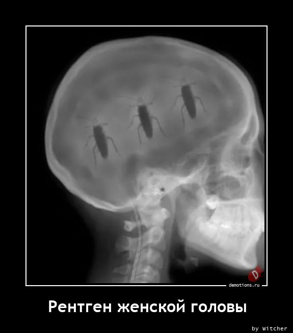 Рентген женской головы